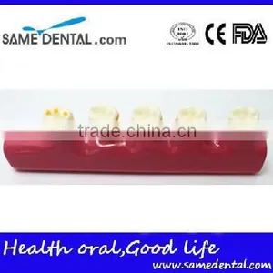 2x Periodontal Disease Classification Models Dental Eduction Assistant No. DEA-20 thumbnail-3