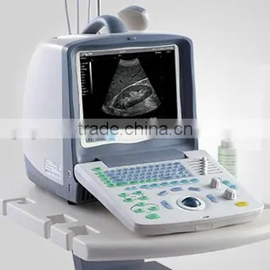 FM-2000 Portable Ultrasound Machine for Sale thumbnail-1