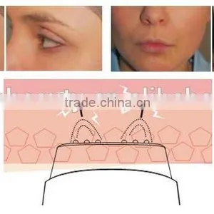 Good Quality Ladies RF Massager Mini Medicines for Lady's rf Skin Tightening Face Lifting Machine for Lady thumbnail-5