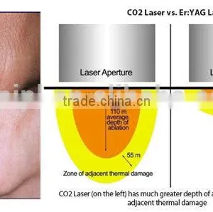 Stretch Mark Removal Acne Scar Removal Laser Laser CO2 Resurfacing Machine From With CE RF Portable Design Fractional Co2 Laser Machine Producers Tumour Removal thumbnail-3