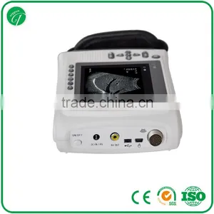 Cheap Chinese Convex Ultrasound Scanning Diagnostic Equipment 3018H thumbnail-3