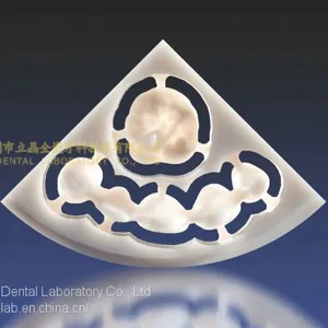 Wieland Zenostar Dental Crown, Solid Zirconia Bruxzir, Dental Teeth, Laboratoire Dentaire, Dentallabor, Laboratorio Dental, Dental Laboratory, Shenzhen LJ Dental Lab China thumbnail-1