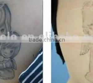Chinese Apolo ISO CE Approved Beauty Machine Top Tattoo Machine thumbnail-3