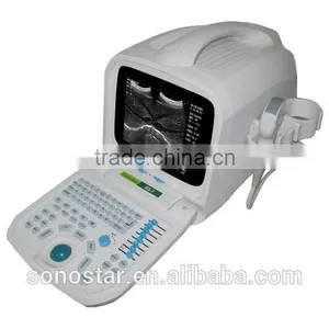 SS-7 Laptop Ultrasound Scanner thumbnail-2