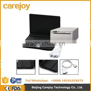 3D Workstaion 10 Inch Laptop Ultrasound Scanner RUS-9000F With 3.5Mhz Convex Probe by CE ISO Approved thumbnail-1