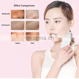 Ultrasonic Ion Skin Scrubber Facial Care Ultrasonic Scrubber Cleaner Blackhead Removal Face Peeling Extractor Skin Beauty Device thumbnail-4