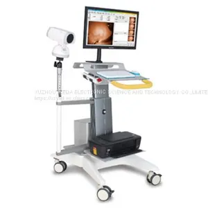 Medical HD ENT Endoscopy Camera thumbnail-1