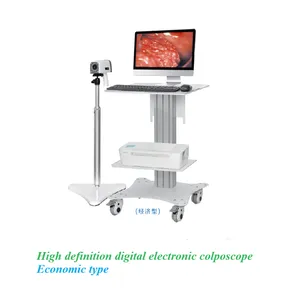 High Definition Digital Electronic Colposcope thumbnail-1