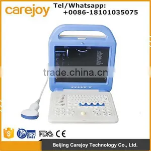 New Portable Full Digital Color Doppler Ultrasound Scanner Diagnostic System 2 Probe With Cheap Price thumbnail-1