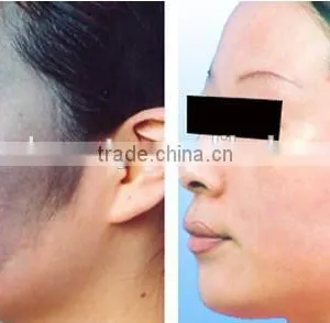 0.5HZ 1064nm 532nm Q Switch Nd Yag Laser Machine Brown Age Spots Removal Remove Pigment And Birthmark Machine Beauty Salon Equipment Supplier thumbnail-6