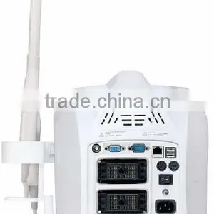 SS-7 Laptop Ultrasound Scanner thumbnail-1