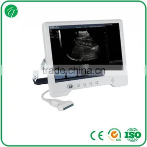 B&W Touch Screen Ultrasound Scanner/machine TS20 thumbnail-1