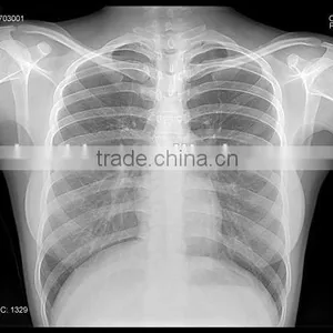 Laser FilmDry Medical Film thumbnail-2