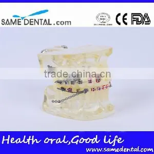 High Quality Dental Transparent Orthodontic Models School Teaching Demonstration thumbnail-1