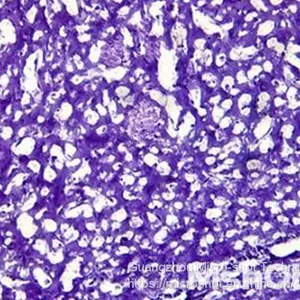 Inverted Biological Microscope With Phase Contrast MI52-N thumbnail-3