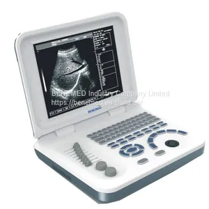 Notebook Type Black and White Ultrasound Scanner Medical Equipment thumbnail-4