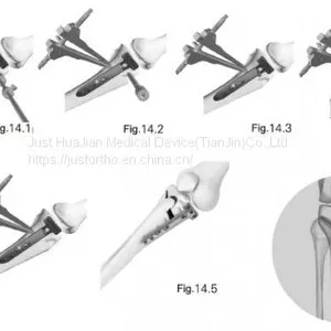 Periarticular Locking Plate System Material: Ti thumbnail-1