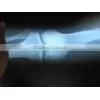 Agfa Film Agfa Dry Films Agfa X-ray Film thumbnail-4