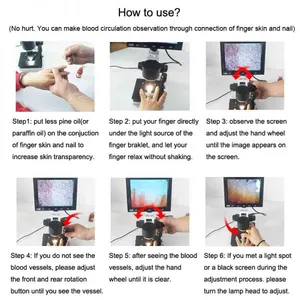 USB Microscope Blood Microcirculation Inspection Zoom Nailfold Capillary Microcirculation Digital Microscope With LCD Screen thumbnail-5
