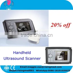 Promotion Palm Ultrasound Scanner HandScan H8 With 3.5 Mhz Convex Probe 5.5 Inch Monitor thumbnail-1