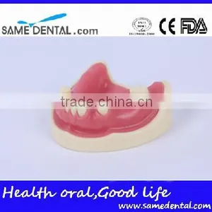 Dental Implant Practice Model With Gingival School Teaching Demonstration Models thumbnail-1