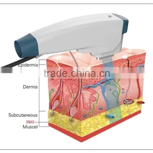 Manufacture HIFRF Beauty Machine Radio Frequency Aesthetics thumbnail-2