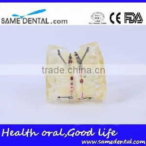 High Quality Dental Transparent Orthodontic Models School Teaching Demonstration thumbnail-3