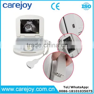 10 Inch Portable Ultrasound Scanner USG Machine With 3.5Mhz Convex Probe for OB/GYN Urology Etc thumbnail-1