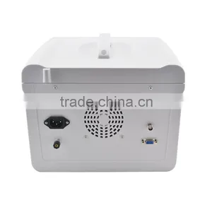 Factory Price!!CE Approved Notebook/Portable Ultrasound Scanner With 3.5Mhz Multi-frequency Convex Probe RUS-6000D thumbnail-3