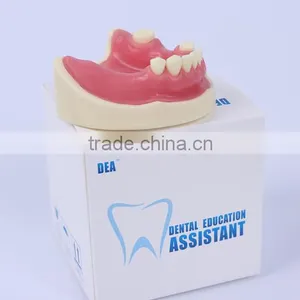 Trade Assurance Hot Dental Implant System CE Approved Dental Implant Model thumbnail-4