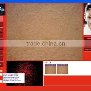 Toppest FCC Approved Patented Taiwan CBS Facial Skin Analyzer thumbnail-5