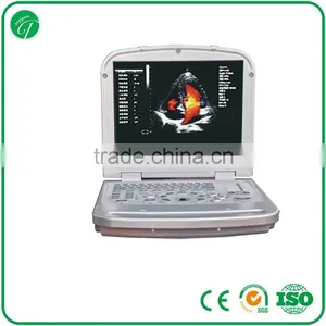 15 Inch Laptop Color Doppler 64G Image-storage Capacity Ultrasound Scanner for Hospital thumbnail-1