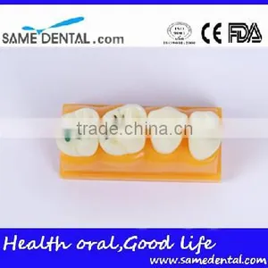 Pit and Fissure Model Dental Eduction Assitant No. DEA-19 thumbnail-1
