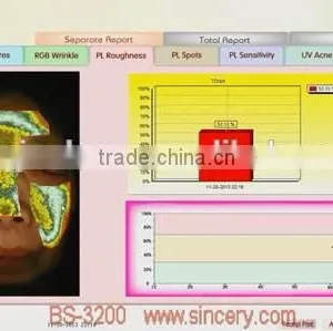 Portable Facial Skin Scanner Analyzer 3D Facial Skin Analysis thumbnail-4