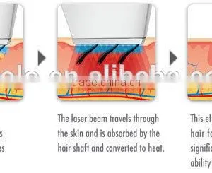 2015 Diode Laser Hair Removal Face Machine For Blond Hair Removal Permanent thumbnail-5