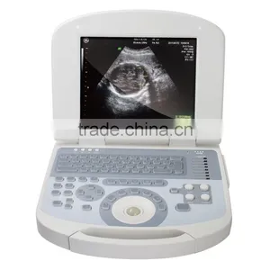 Diagnostic Machine Device Full Digital Pregnancy Scanner Ultrasound thumbnail-1