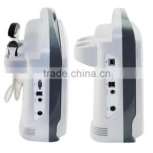 2015 Hot Selling Veterinary Instrument Ultrasound Scanner ECO1 VET With 2.5-11MHz Probe Frequency thumbnail-5