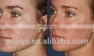 Vagina Tightening Skin Resurfacing Fractional Co2 Laser 8.0 Inch Vaginal RF Tightening Machine With Aluminum Case thumbnail-4