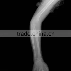 Ccd Flat Panel X-ray Detector 14x17 thumbnail-5