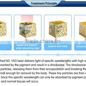 2016 Varicose Veins Laser Treatment Pigments Tattoo Removal nd Yag Laser Machine Prices thumbnail-6