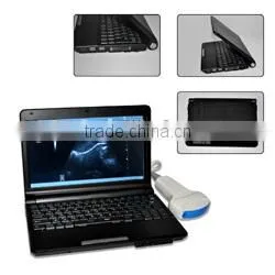 Notebook Ultrasound Scanner RUS-9000F With 3.5Mhz Convex Probe and 7.5Mhz Linear Probe Diagnosis Machine thumbnail-2