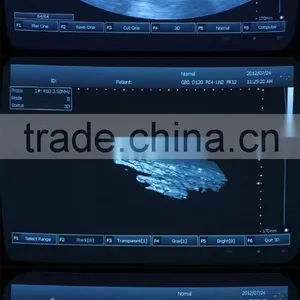 Lowe Price Medical Equipment Portable Cheap Ultrasound Scanner/Machine 3.5Mhz Multi-frequency Convex Probe thumbnail-3