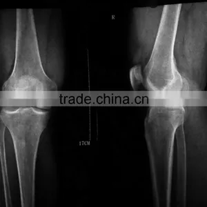 Radiography Film + Dental , X-ray Blue Film of Suppliers of Hospital Products thumbnail-1