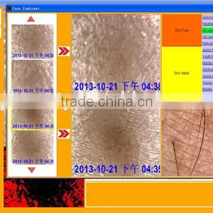 AYJ-J019 Facial Skin Moisture Monit Analyzer/digital Skin Analyzer thumbnail-4