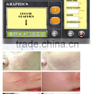 Hot Sell Pigmentaion Removal Fractional CO2 Laser K11 thumbnail-1