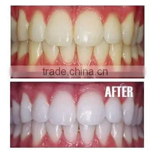 Teeth Whitening Tooth Whitener Gel Pen thumbnail-3