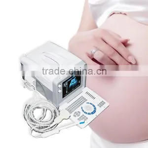 2016 Cheap Price Portable Full Digital Ultrasound Scanner/Machine With Probe/Transducers-RUS-6000D thumbnail-2