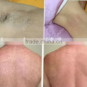 Strong Power!!! 808nm Diode Laser HairRemoval Machines With CE/ HOT!Painless and Powerful Fast Hair Removal 808 DiodeLaser thumbnail-4