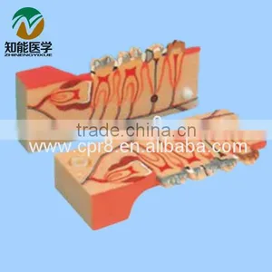 Tooth Decomposition Model of the Organization BIX - L1003 thumbnail-1