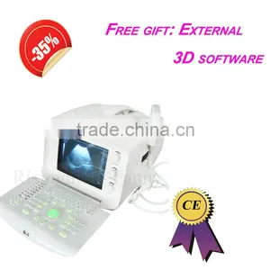 Promotion!!CE Approved Notebook USB Ultrasound Scanner With 3.5Mhz Multi-frequency Convex Probe RUS-6000A thumbnail-1